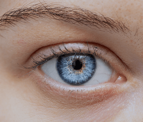 optomap retinal imaging